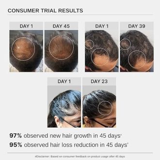 Bare Anatomy Advanced Hair Growth Serum | 3% Redensyl + 4% Anagain + 3% Baicapil + 1% Capilia Longa, Rosemary, Biotin & Rice Extract | Hair growth & Hair fall control serum for Women & Men | 30mL - Image 5