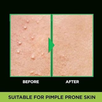 Garnier Men Acno Fight Anti Pimple Face Wash, Anti Pimple Face Wash with Salicylic Acid and Herba Repair, Suitable for all Skin Types, 150g - Image 6