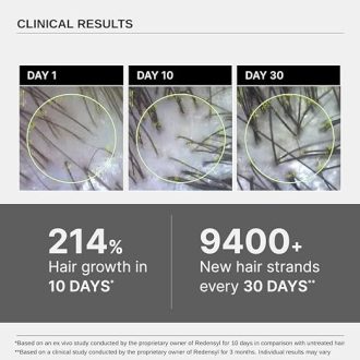 Bare Anatomy Advanced Hair Growth Serum | 3% Redensyl + 4% Anagain + 3% Baicapil + 1% Capilia Longa, Rosemary, Biotin & Rice Extract | Hair growth & Hair fall control serum for Women & Men | 30mL - Image 4