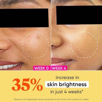 Dot & Key Vitamin C + E Sorbet Super Bright Moisturizer for Face | Vitamin C Face Cream For Glowing Skin | Reduces Skin Dullness | Oil Free & Lightweight | For All Skin Types | 25ml - Image 5