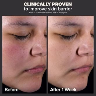 Paula's Choice-Skin Perfecting 2% BHA Liquid Salicylic Acid Exfoliant-Facial Exfoliant for Blackheads, Enlarged Pores, Wrinkles, Fine Lines - Image 2
