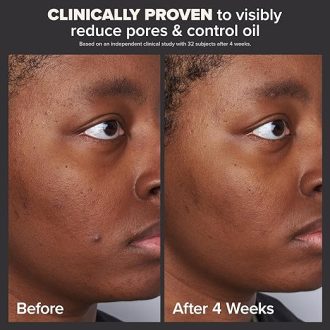 Paula's Choice-Skin Perfecting 2% BHA Liquid Salicylic Acid Exfoliant-Facial Exfoliant for Blackheads, Enlarged Pores, Wrinkles, Fine Lines - Image 3