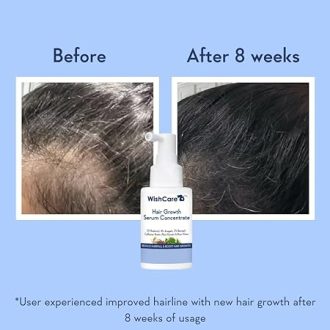 WishCare Hair Growth Serum Concentrate - 3% Redensyl, 4% Anagain, 2% Baicapil, Caffeine, Biotin, Plant Keratin & Rice Water - Hair Growth Serum for Men & Women - Image 3
